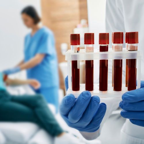 🩸 Mikroplastik im Blut - Leider kein Mythos mehr.